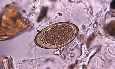 Count Your Faecal Parasite Worm Eggs Before They Hatch
