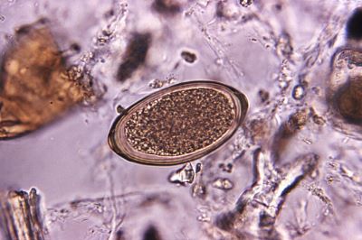 Count Your Faecal Parasite Worm Eggs Before They Hatch