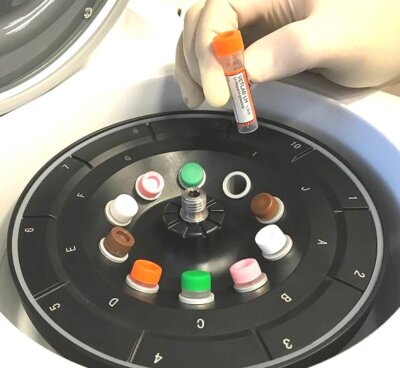 How and Why to Balance Your Centrifuge