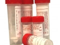 Boric Acid Urine Collection Containers, 30ml and 5ml Bijou Sizes